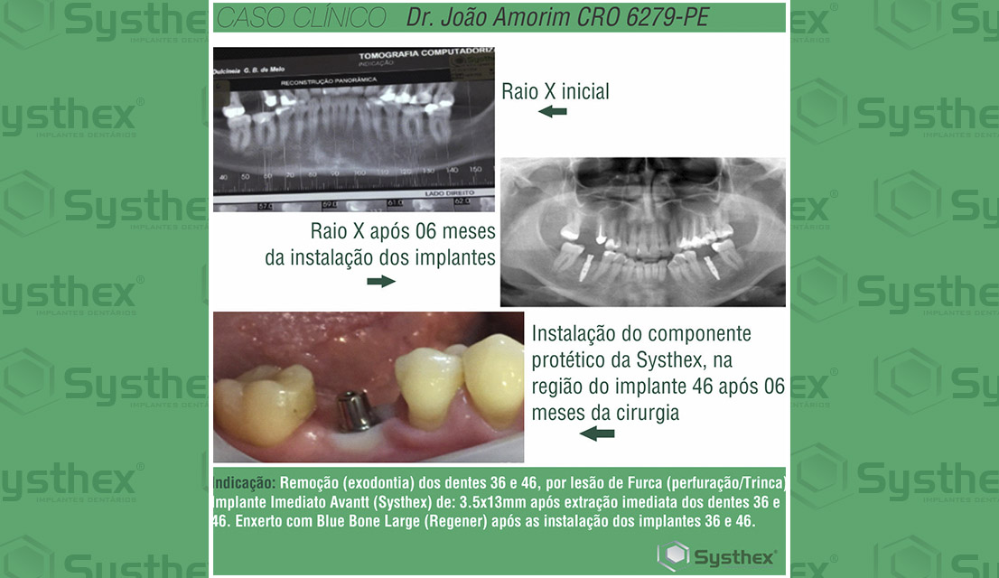 Caso clinico cedido pelo Prof. Dr. João Carlos Amorim.