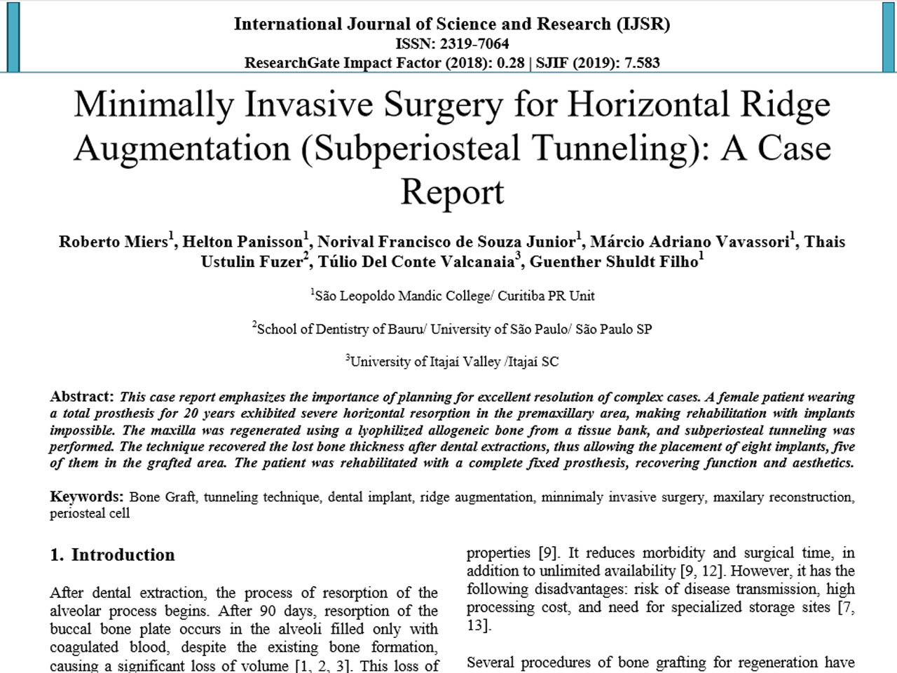 Minimally Invasive Surgery for Horizontal Ridge Augmentation