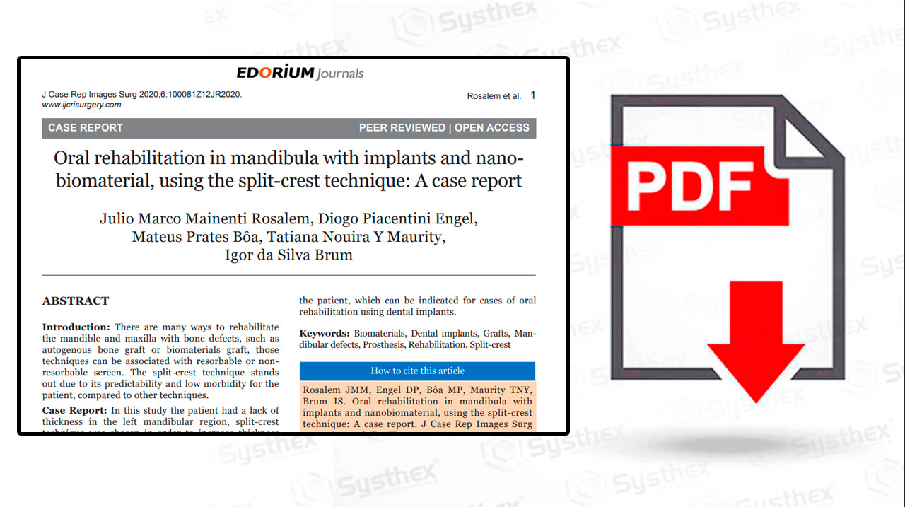 thumb-edorium-systhex-implantes-caso-clinico-Oral-rehabilitation-mandibula