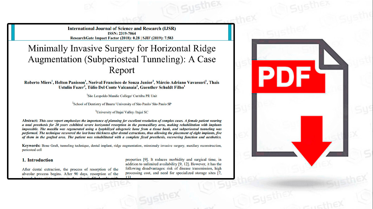 thumb-systhex-implantes-Minimally-Invasive-Surgery-for-Horizontal-Ridge